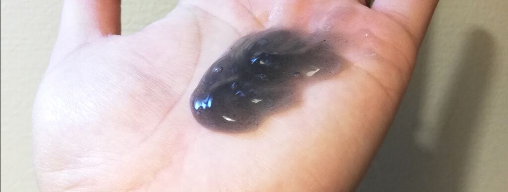 JUSO KURO PEELING（重曹配合ピーリングジェル）/NAKUNA-RE/ピーリングを使ったクチコミ（3枚目）