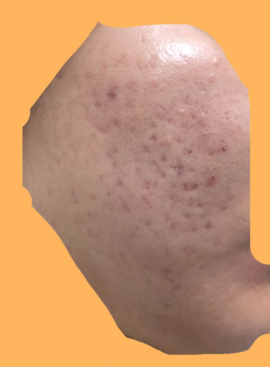 薬用しみ対策 美白化粧水/メラノCC/化粧水を使ったクチコミ（3枚目）