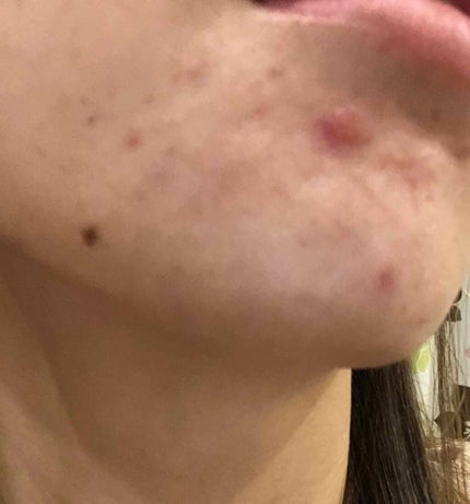 を使ったクチコミ(1枚目)