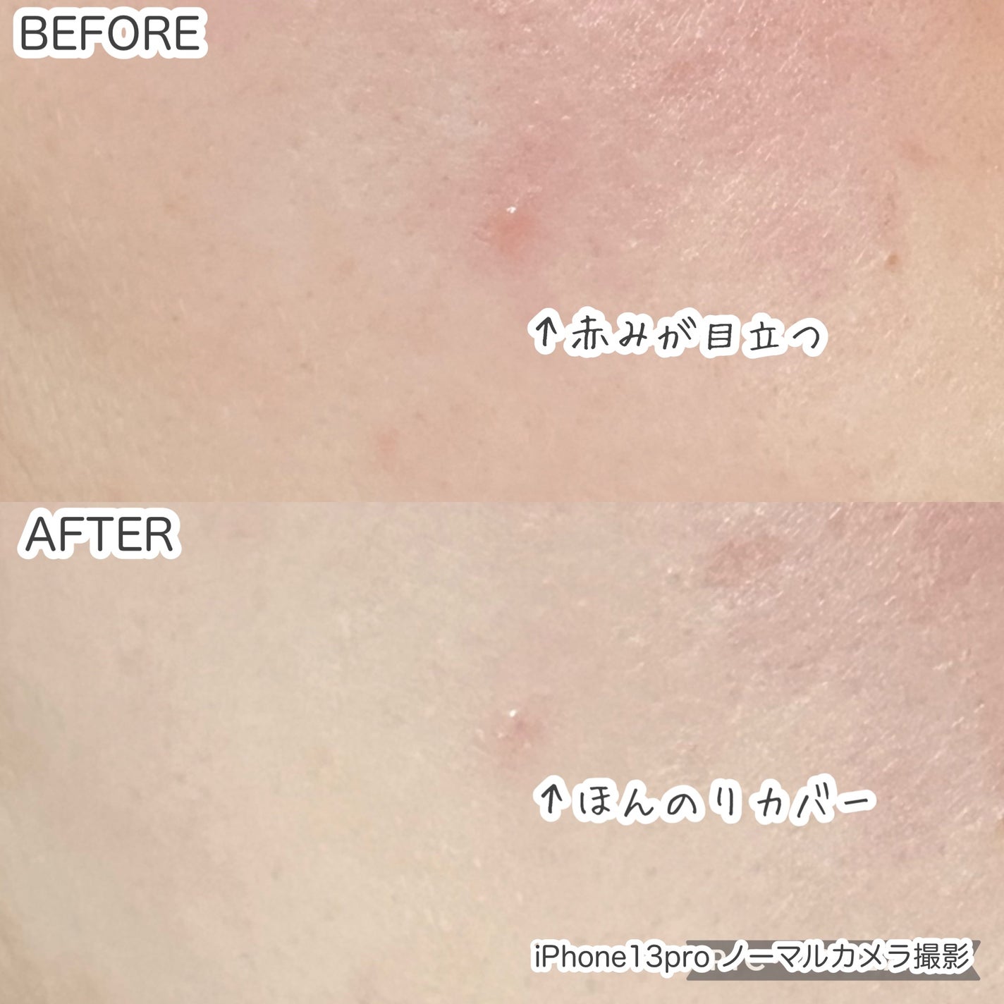 イプノス シーバムクリア リペアクリーム/ACSEINE/フェイスクリームを使ったクチコミ(4枚目)