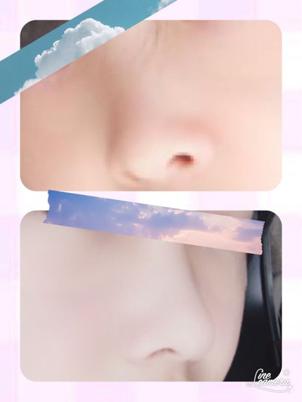 美鼻セレブ ノーズクリップ/O.M.C TOKYO/その他を使ったクチコミ(1枚目)