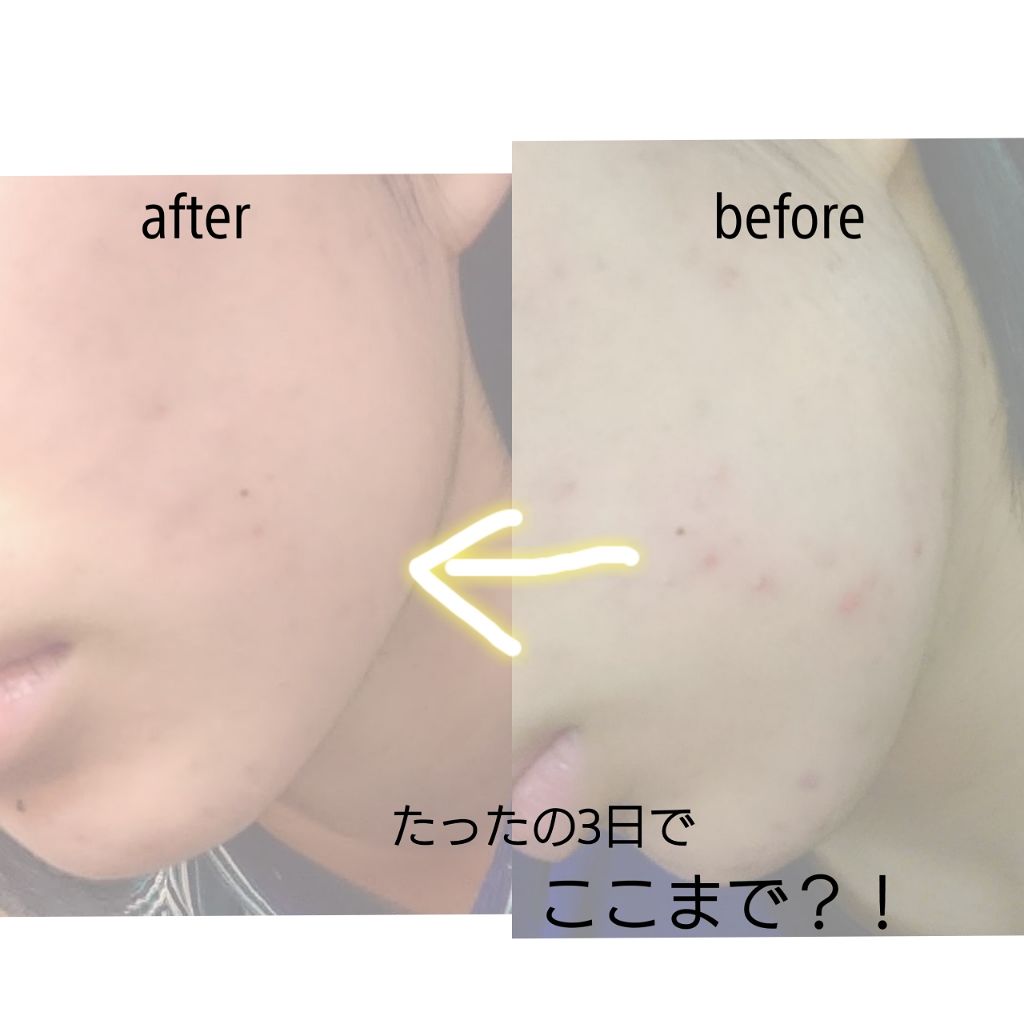 化粧水・敏感肌用・高保湿タイプ/無印良品/化粧水を使ったクチコミ（1枚目）