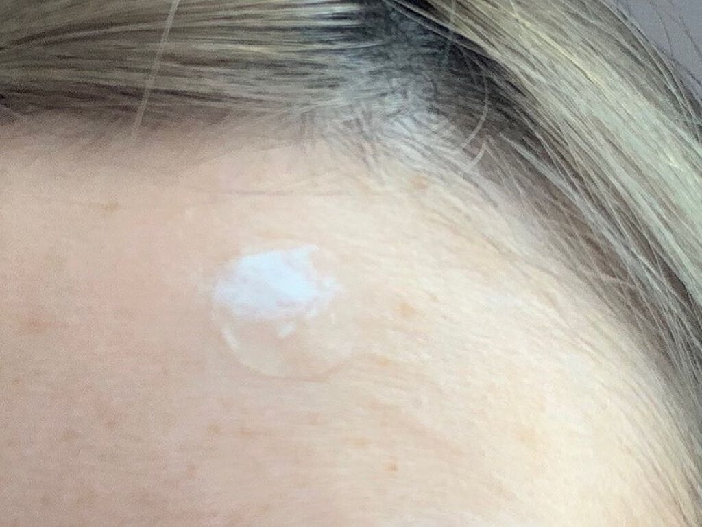 薬用ニキビケア スポッツクリーム/アクネスラボ/フェイスクリームを使ったクチコミ(5枚目)