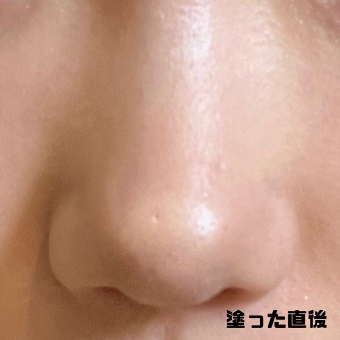 ダーマシンコンシーラー/23years old/リキッドコンシーラーを使ったクチコミ(4枚目)