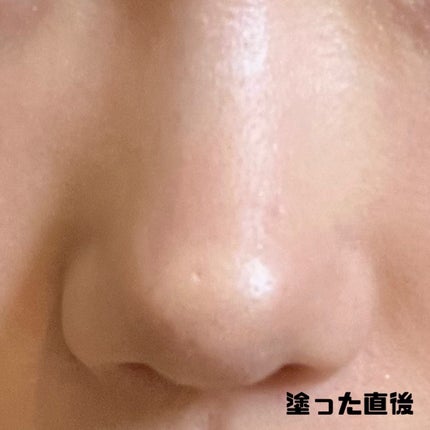 ダーマシンコンシーラー/23years old/リキッドコンシーラーを使ったクチコミ(4枚目)