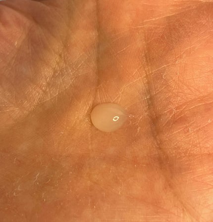 CICA method RECOVER PATCH/コジット/その他スキンケアを使ったクチコミ(3枚目)