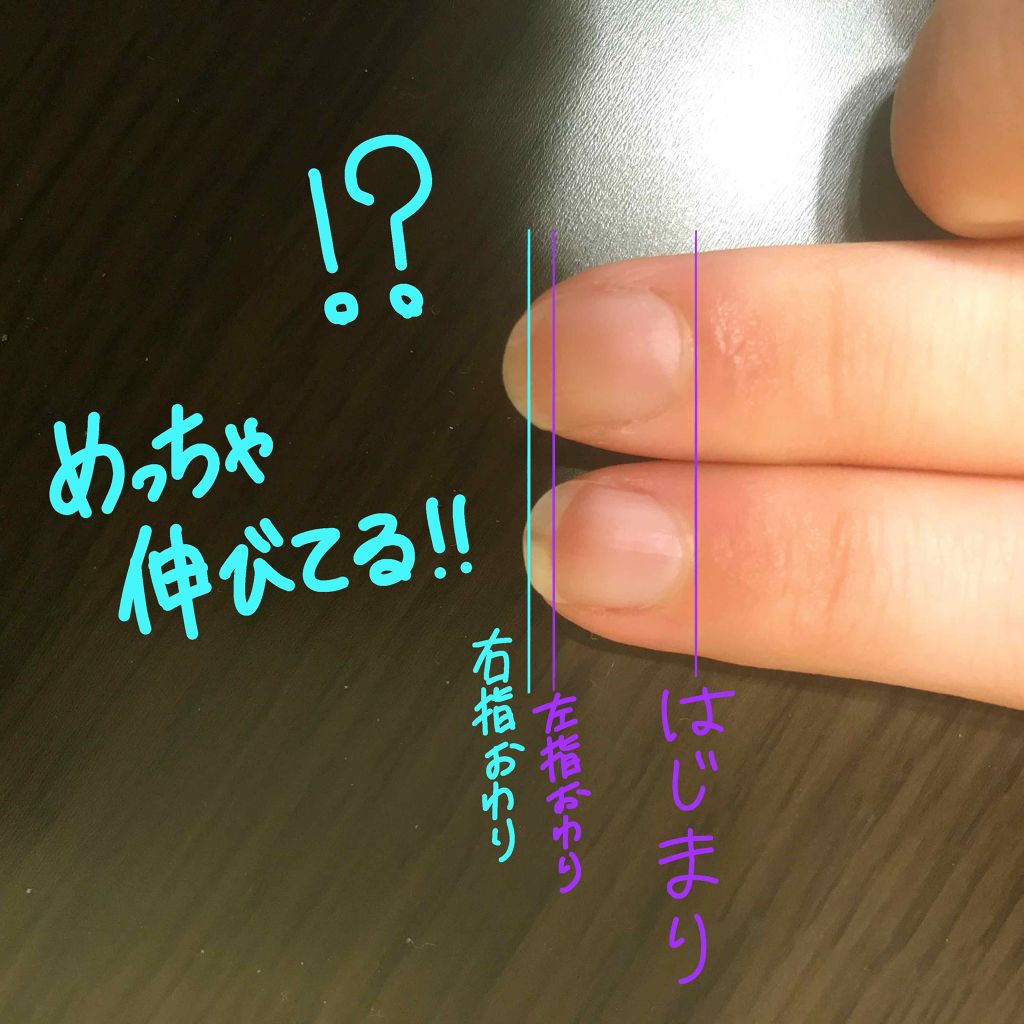 AC キューティクルオイル/AC MAKEUP/ネイルオイル・トリートメントを使ったクチコミ（2枚目）