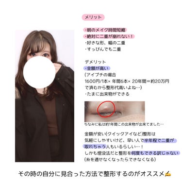 えむむ on LIPS 「【一般人女性23歳が二重整形した話】ぶっちゃけ二重整形ってどう..」（3枚目）