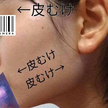 導入化粧液 無印良品を使った口コミ 皮むけもだいぶ収まってきました スキンケア By ちはる スキンケア特化型 敏感肌 代後半 Lips 導入化粧液 無印良品を使った口コミ 皮むけもだいぶ収まってきました スキンケア By ちはる スキンケア特化型 敏感肌 代後半 Lips