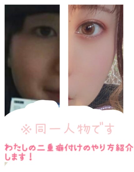 アイテープ片面(のびる)絆創膏タイプ スリム 120枚/セリア/二重まぶた用アイテムを使ったクチコミ(1枚目)