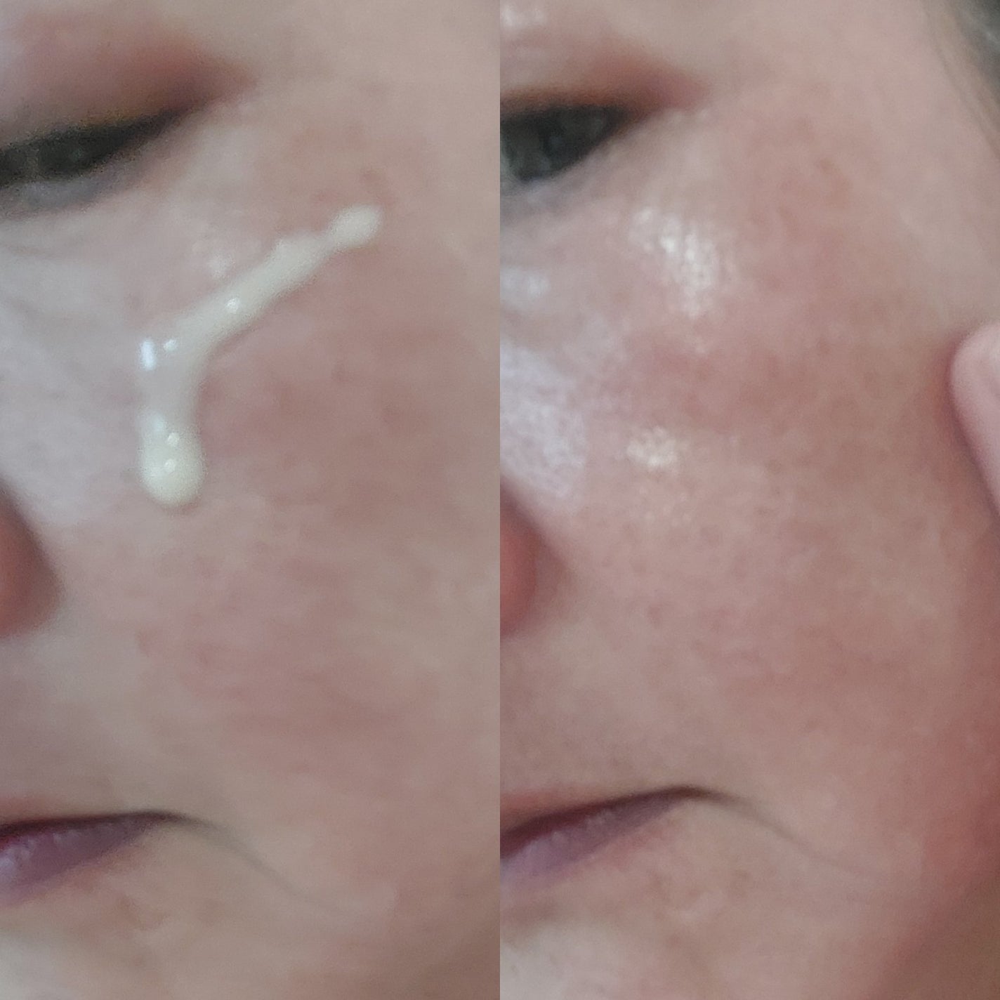 ブラックスネイルレチノールセラム/Dr.G/美容液を使ったクチコミ(5枚目)