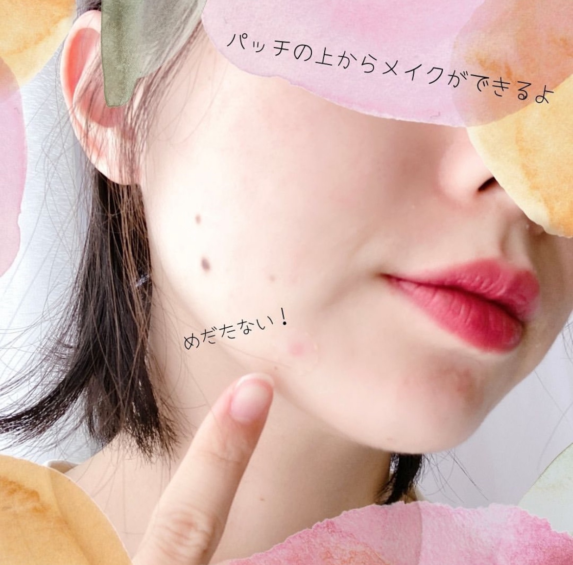 極薄透明パッチ nikipa!/金冠堂/にきびパッチを使ったクチコミ（3枚目）