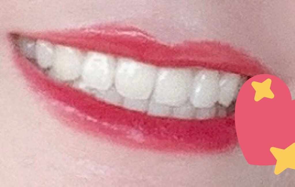 シュミテクト トゥルーホワイト/シュミテクト/歯磨き粉を使ったクチコミ（2枚目）