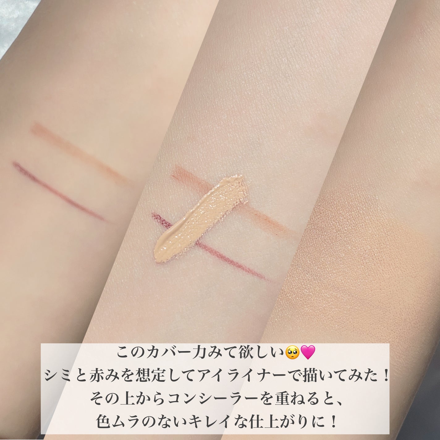 ミネラルインナートリートメントリキッドコンシーラー/エトヴォス/リキッドコンシーラーを使ったクチコミ(7枚目)