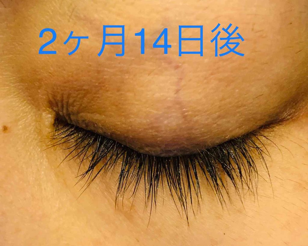 EMAKED(エマーキット)/水橋保寿堂製薬/まつげ美容液を使ったクチコミ(4枚目)