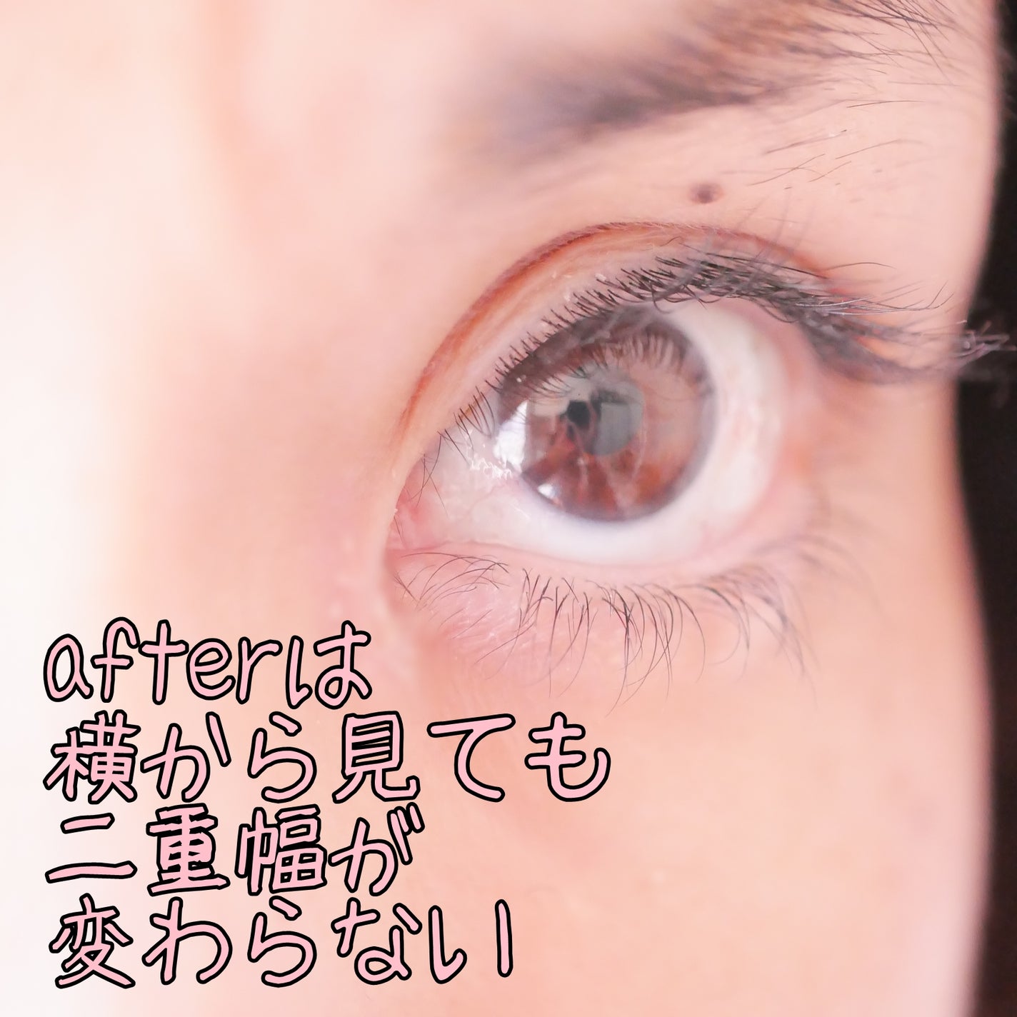 メザイク クリップ カッター ファイバー専用カッター/メザイク/二重まぶた用アイテムを使ったクチコミ(8枚目)