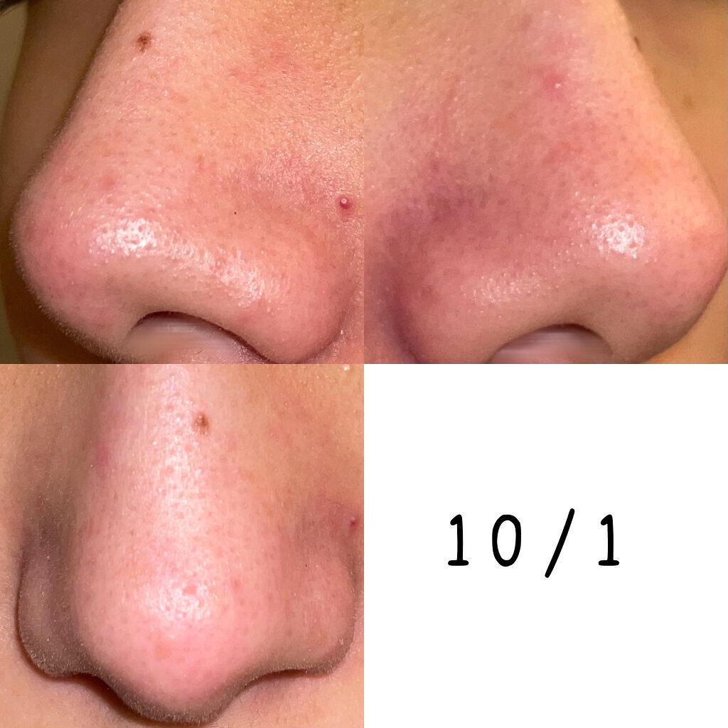 ホホバオイル/無印良品/ボディオイルを使ったクチコミ(6枚目)