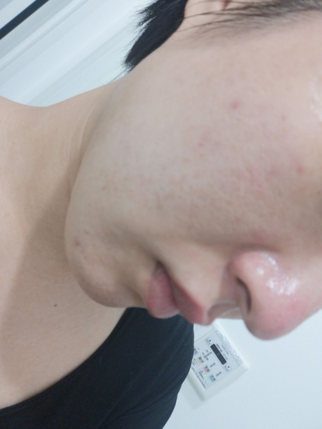 fabulous_glow_rnlr on LIPS 「スッピンです。前よりいい感じがするこれからも継続します!スキン..」(1枚目)