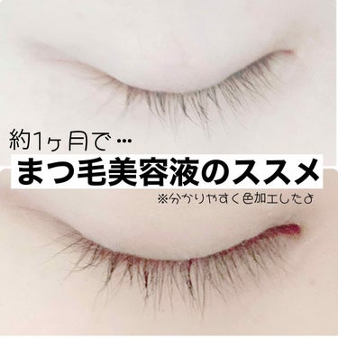 LINP リンプラッシュのクチコミ「✨LINP LASH アイラッシュセラム✨
まつ毛美容液 日本製 4mg(約2ヶ月分)
Ama.....」（1枚目）