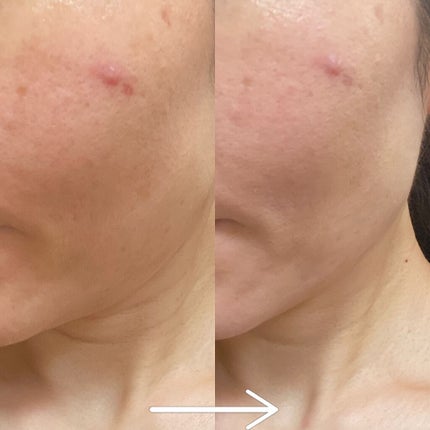 BB+CCクリーム/+OneC(プラワンシー)/BBクリームを使ったクチコミ(4枚目)