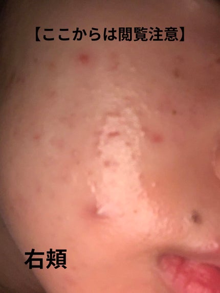 ミノン アミノモイスト モイストチャージ ミルク/ミノン/乳液を使ったクチコミ(5枚目)