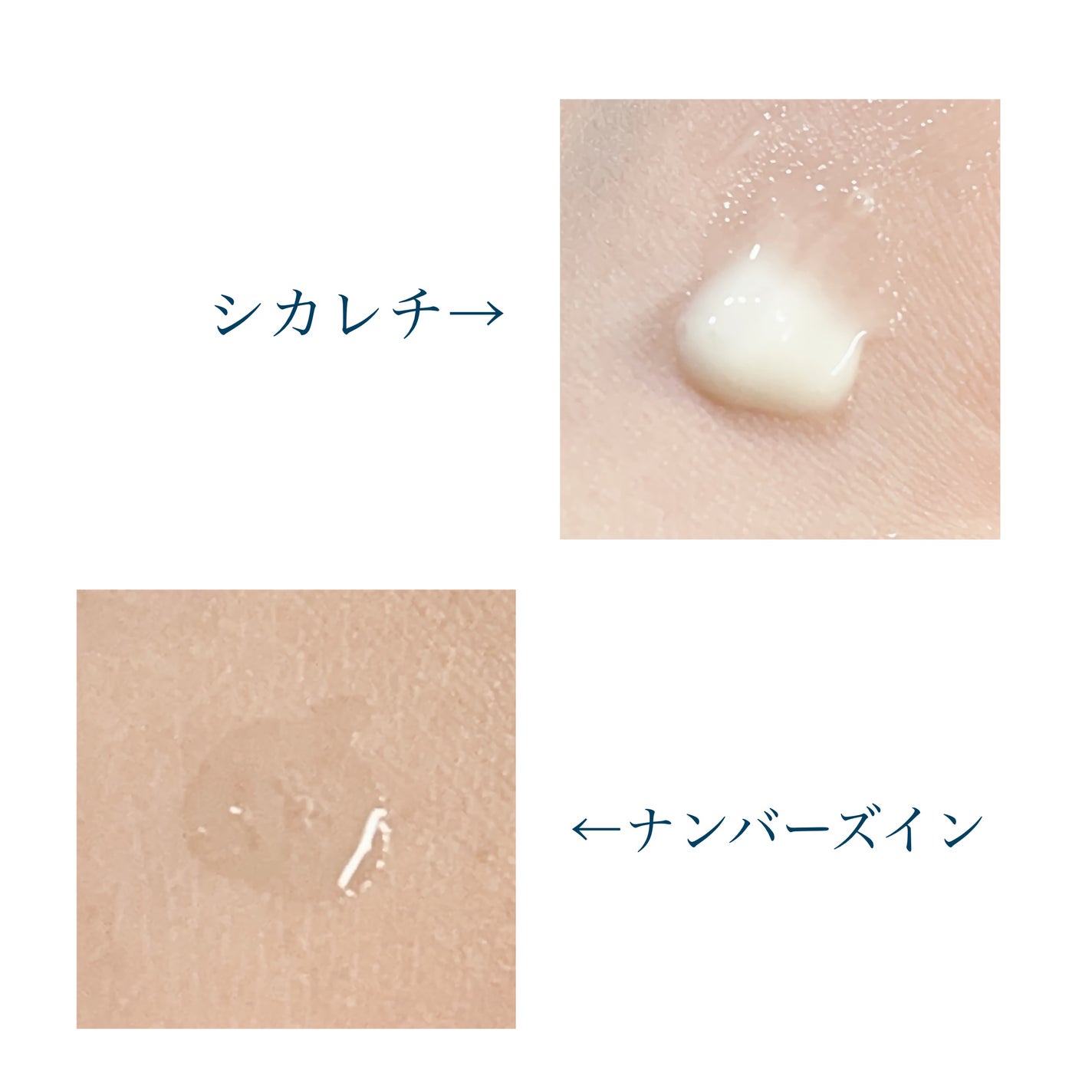 シカレチA エッセンス0.1/VT/美容液を使ったクチコミ(2枚目)