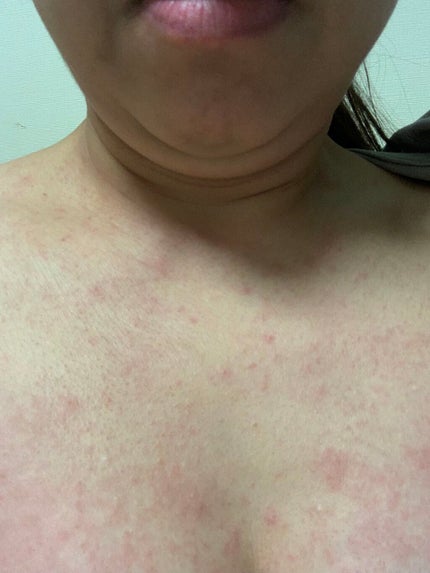 モイスチャーバーム ジャー/キュレル/フェイスクリームを使ったクチコミ(3枚目)