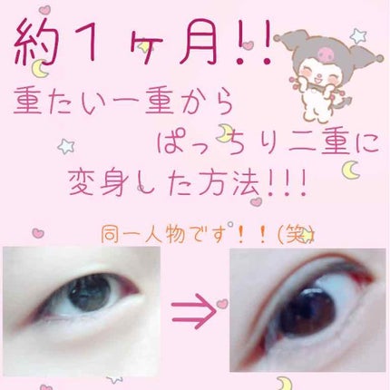 マルチゲル AL/ETUDE/その他スキンケアを使ったクチコミ(1枚目)