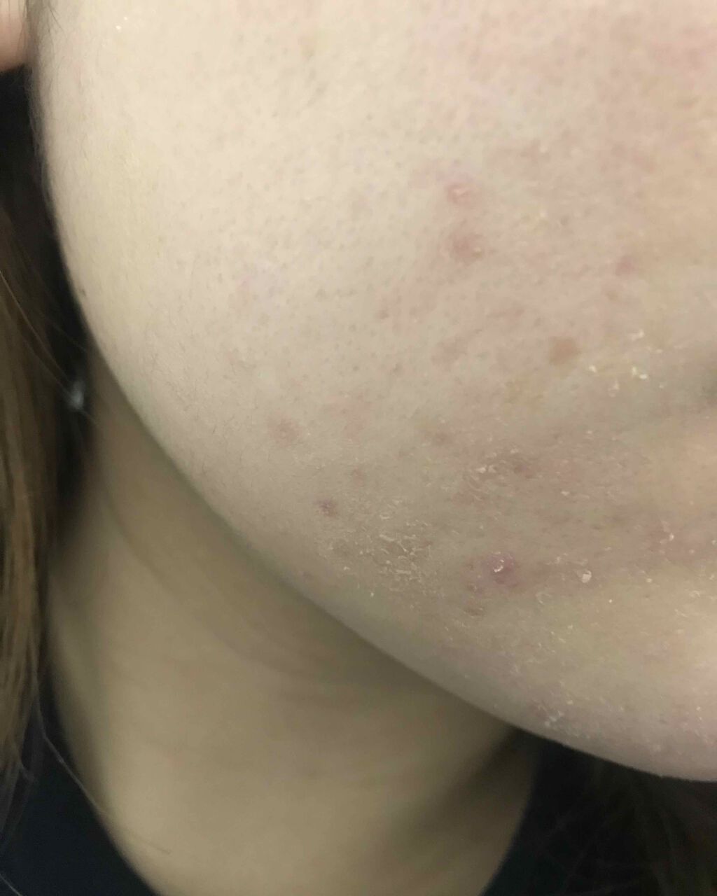 天使の優しさ/ラッシュ/その他洗顔料を使ったクチコミ(1枚目)