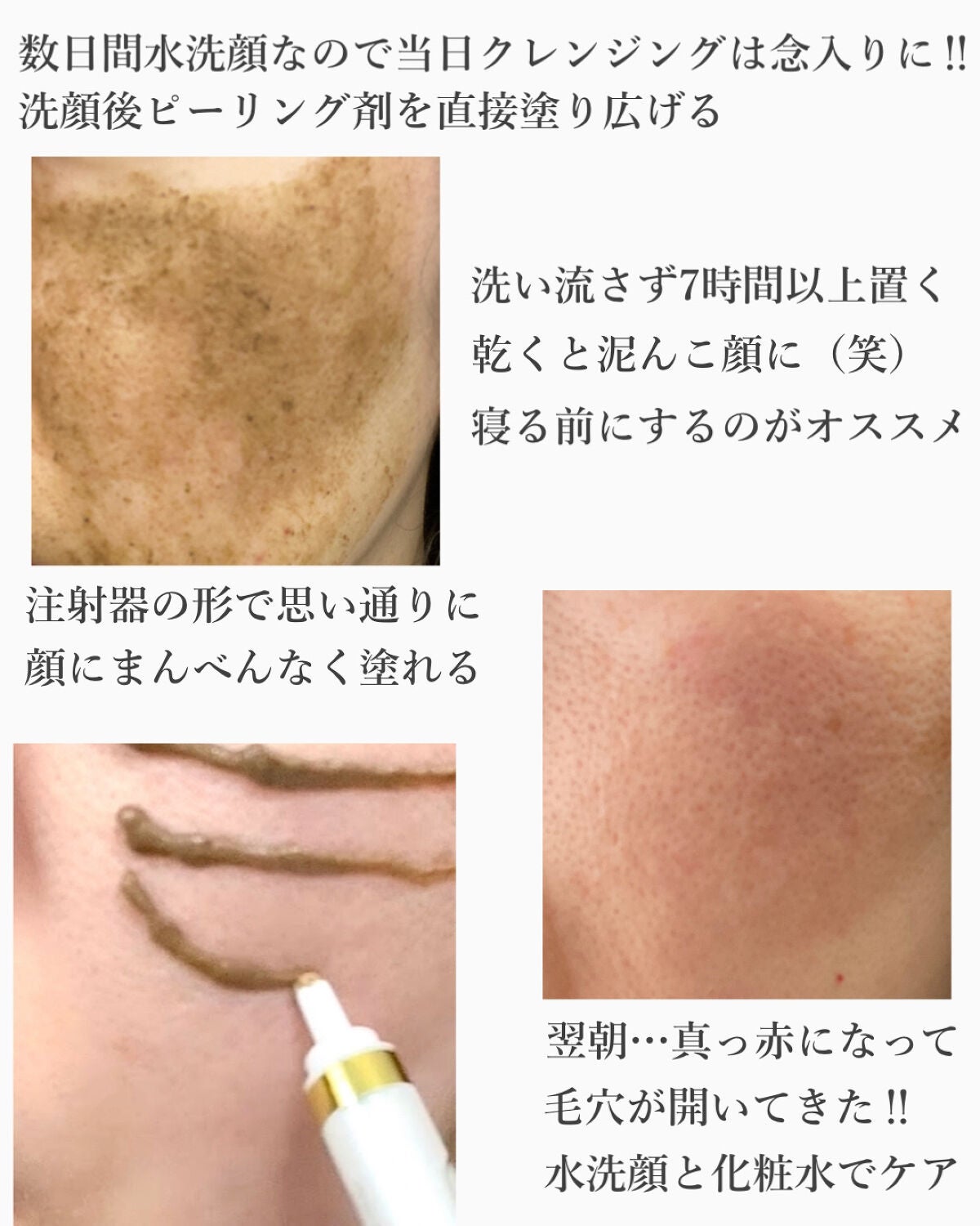 ダーマスキンピーリング/BQCELL/その他キットセットを使ったクチコミ(3枚目)