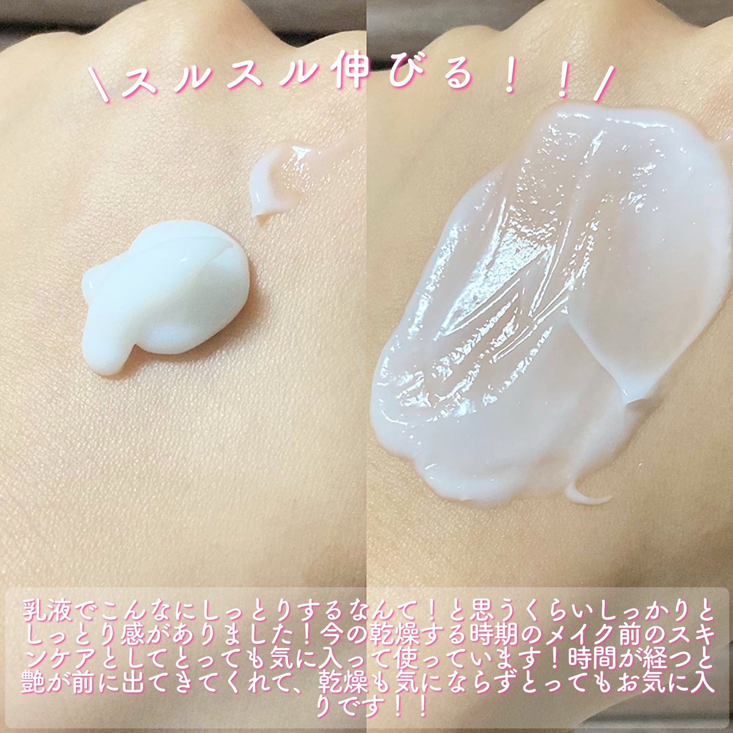 セタフィル モイスチャライジングローション/セタフィル/ボディローションを使ったクチコミ(3枚目)