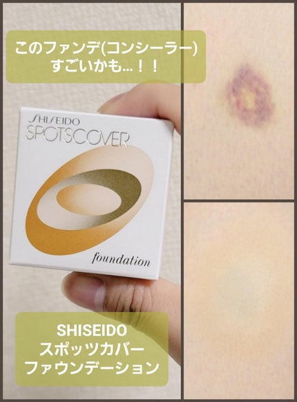 スポッツカバー ファウンデイション/SHISEIDO/クリームコンシーラーを使ったクチコミ(1枚目)