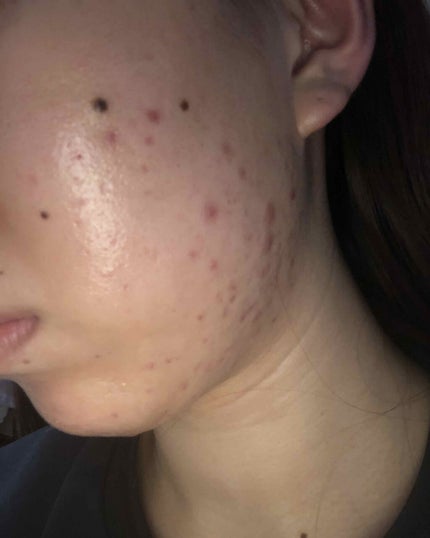 敏感肌用薬用美白美容液/無印良品/美容液を使ったクチコミ(1枚目)