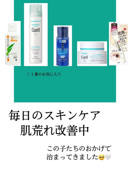 オードムーゲ 薬用ローション(ふきとり化粧水)/オードムーゲ/拭き取り化粧水を使ったクチコミ(1枚目)