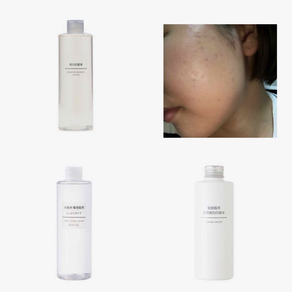 ある on LIPS 「<2019.9.15>前回のスキンケア(宜しければ前回の投稿を..」(2枚目)