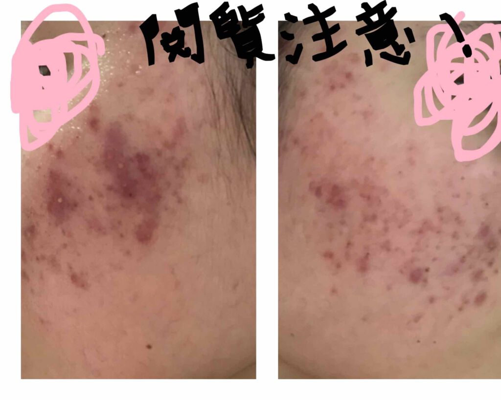 アルビオン 薬用スキンコンディショナー エッセンシャル/ALBION/化粧水を使ったクチコミ（2枚目）