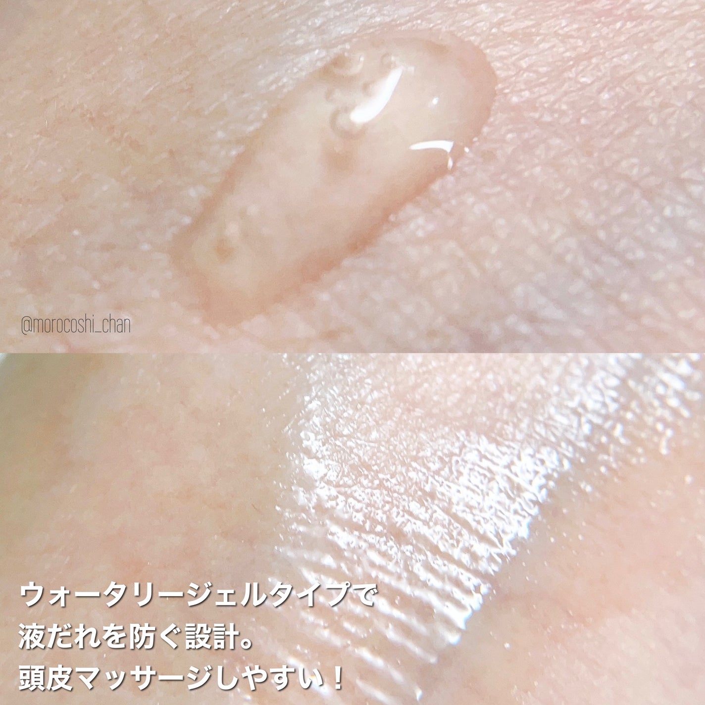 キュートヘアケアエッセンス/iqumore/頭皮ローションを使ったクチコミ(4枚目)