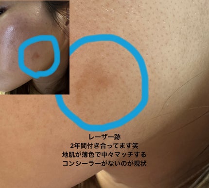 カラーデュオ トリック コンシーラー/Visée/パレットコンシーラーを使ったクチコミ(3枚目)