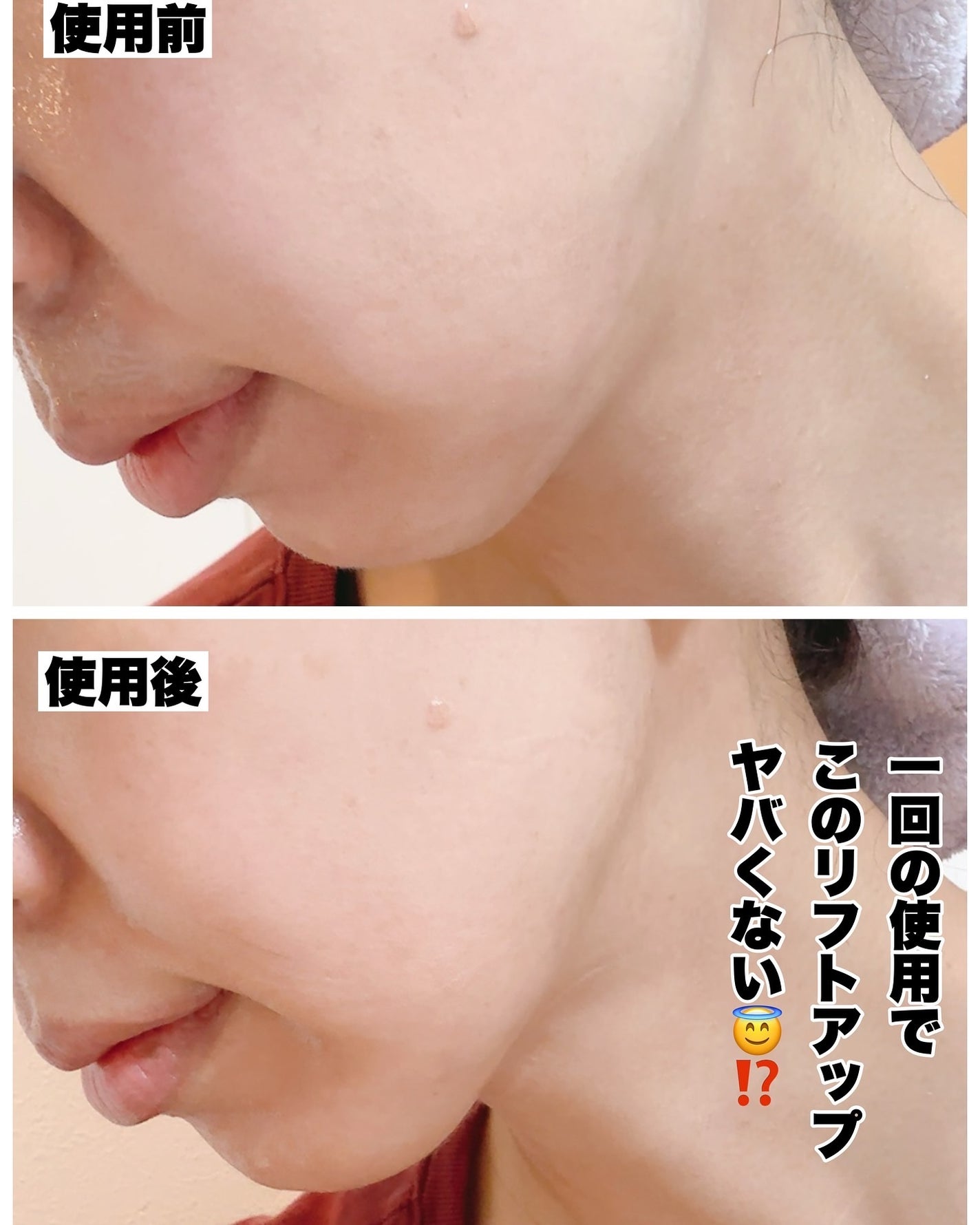 9番 NMNバイオリフトラッピングマスク/numbuzin/シートマスク・パックを使ったクチコミ(2枚目)