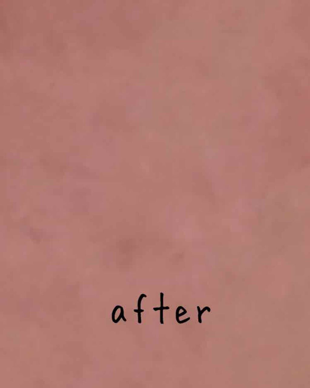 薬用パウダー化粧水/メンソレータム アクネス/化粧水を使ったクチコミ（3枚目）