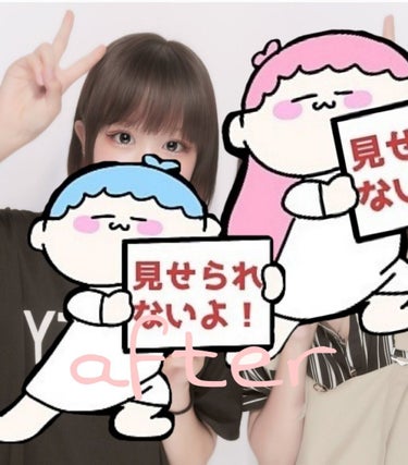 さや on LIPS 「大変お久しぶりです〜！もう少しで整形してから1年が経とうとして..」（2枚目）