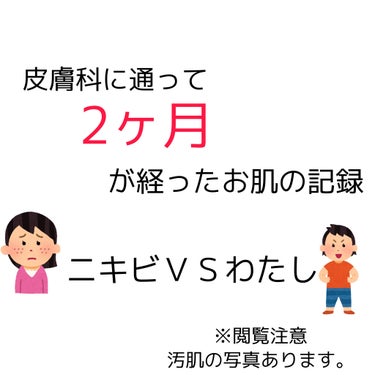 ディフェリンゲル0.1% /マルホ株式会社/その他を使ったクチコミ（1枚目）