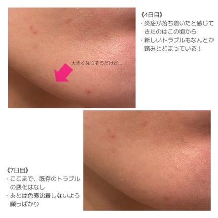 セラムオプティマイザー/AYURA/美容液を使ったクチコミ(6枚目)