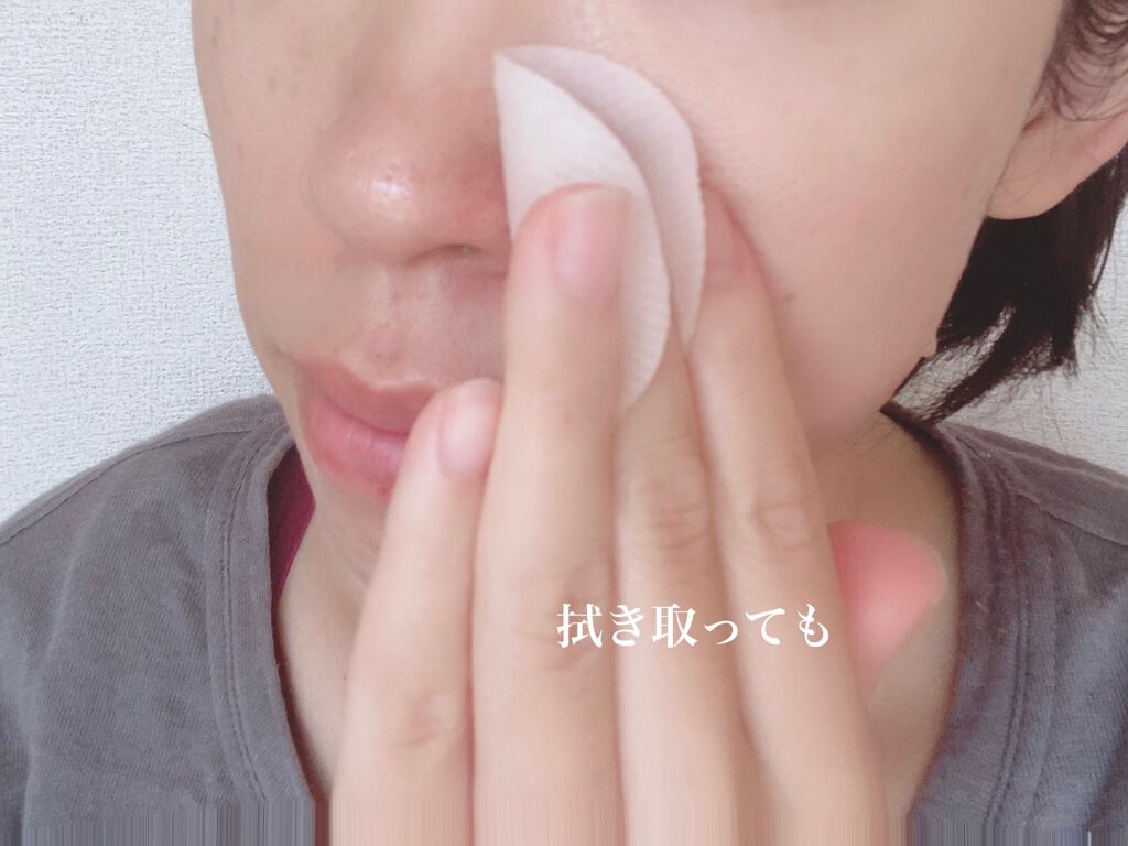 ドクダミカーミングタッチスポットパッド/Abib /トナーパッドを使ったクチコミ(4枚目)