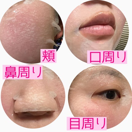 ごめんね素肌マスク/クリアターン/シートマスク・パックを使ったクチコミ(3枚目)