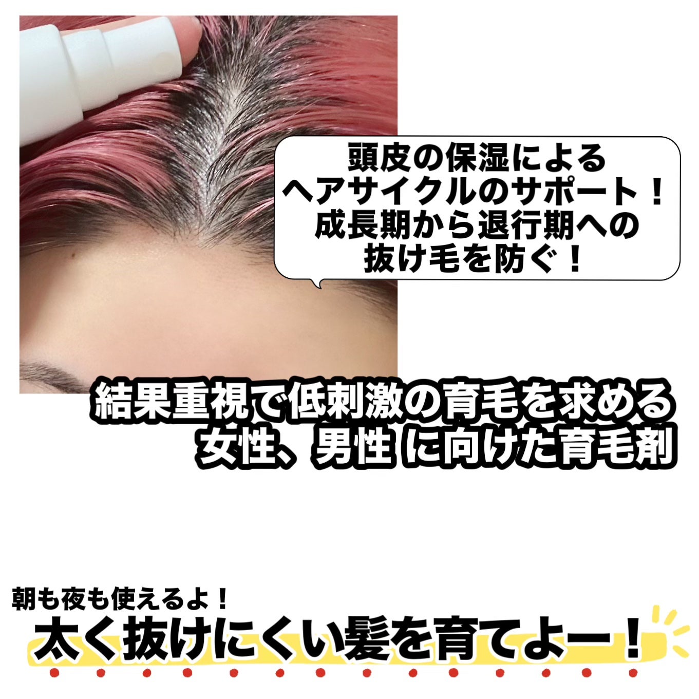 オーリム 育毛剤/OLIM/頭皮ローションを使ったクチコミ(3枚目)