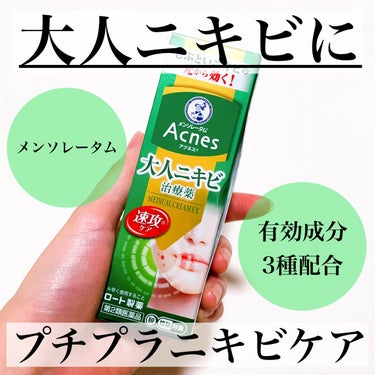 メンソレータム アクネス ニキビ治療薬(医薬品)のクチコミ「\赤ニキビ・痛いニキビに/
どうにかしたいニキビ対策🍀

⭐️⭐️⭐️⭐️⭐️⭐️⭐️⭐️⭐️.....」（1枚目）