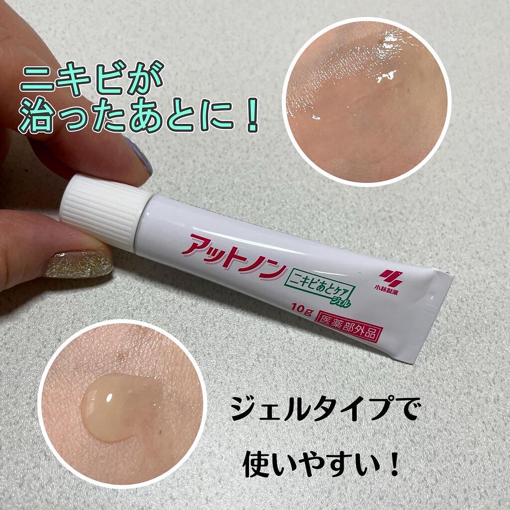 natsumi on LIPS 「.ニキビが治ったあとに使う【アットノンニキビあとケアジェル】...」(1枚目)