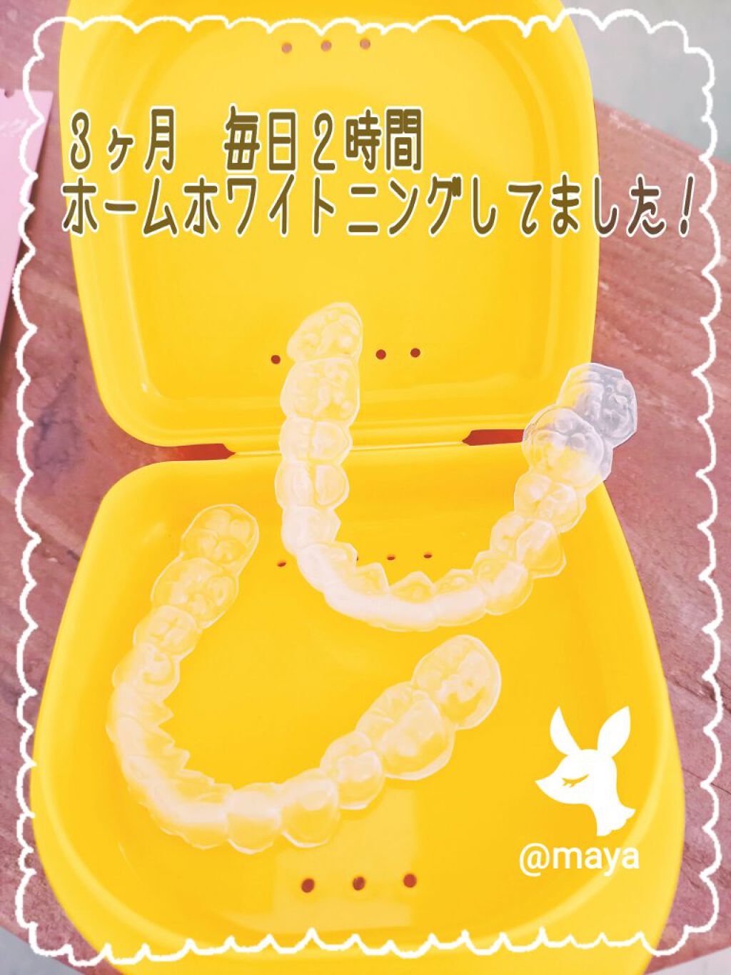 mayað§¡ on LIPS ãããããã¯ã€ããã³ã°ç¶ç¶äžâ¥ïžæ¯ã®åçã¯ç¡å å·¥â¥ïžã¿ãªãããã..ãïŒ4æç®ïŒ