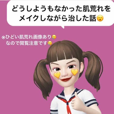 🤭どうしようもないなかった肌荒れをメイクしながら治した話🤭

こんにちは！きなこもちです！💛

私は中二の頃から思春期ニキビが出来始めてそれからずーーーっと今もニキビに悩まされています😢
私はYouTu